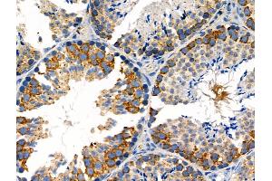 Phospho-MEKK1 (Thr1400) Antibody at 1/100 staining Mouse testis tissue by IHC-P.