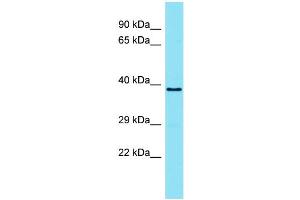 Host: Rabbit Target Name: TMEM121 Sample Type: ACHN Whole Cell lysates Antibody Dilution: 1. (TMEM121 Antikörper  (N-Term))