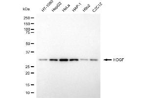 Western blotting analysis using HDGF antibody (ABIN7798891).