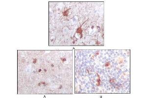 Immunohistochemical analysis of paraffin-embedded human brain (A) and human thymus tissues (B), showing cytoplasmic localization using S100B mouse mAb with DAB staining.