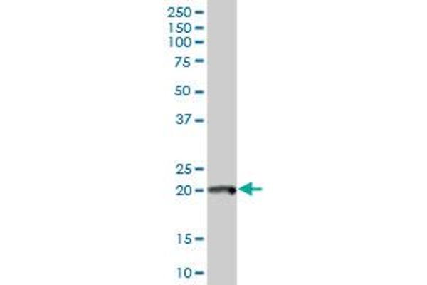 POLE3 Antikörper  (AA 1-147)