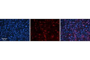 Rabbit Anti-CRSP9 Antibody      Formalin Fixed Paraffin Embedded Tissue: Human Adult Liver   Observed Staining: Nuclear (strong) in hepatocytes, strong signal, wide tissue distribution  Primary Antibody Concentration: 1:100  Secondary Antibody: Donkey anti-Rabbit-Cy3  Secondary Antibody Concentration: 1:200  Magnification: 20X  Exposure Time: 0.