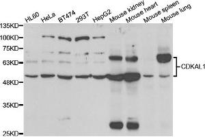 Western blot analysis of extracts of various cell lines, using CDKAL1 antibody (ABIN5973393) at 1/1000 dilution. (CDKAL1 Antikörper)