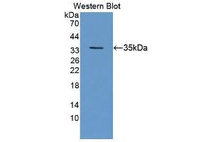 Western blot analysis of the recombinant protein. (Geminin Antikörper  (AA 8-206))