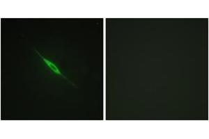 Immunofluorescence analysis of NIH-3T3 cells, using PKC delta (Phospho-Tyr52) Antibody. (PKC delta Antikörper  (pTyr52))