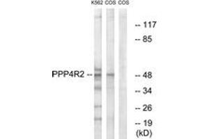 Western blot analysis of extracts from K562/COS7 cells, using PPP4R2 Antibody. (PPP4R2 Antikörper  (AA 171-220))