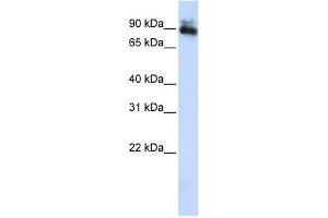 WB Suggested Anti-SP4 Antibody Titration:  0. (SP4 Antikörper  (Middle Region))