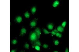 Anti-C1S mouse monoclonal antibody (ABIN2455521) immunofluorescent staining of COS7 cells transiently transfected by pCMV6-ENTRY C1S (RC218963). (C1S Antikörper)