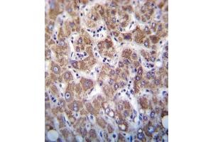 APOC2 Antibody immunohistochemistry analysis in formalin fixed and paraffin embedded human liver tissue followed by peroxidase conjugation of the secondary antibody and DAB staining. (Apolipoprotein C-II Antikörper  (AA 45-73))