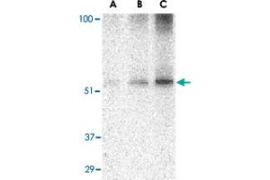 Western blot analysis of TANK in Daudi cell lysate with TANK polyclonal antibody  at (A) 0. (TANK Antikörper  (C-Term))