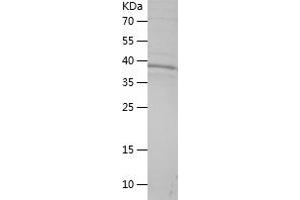 Western Blotting (WB) image for Dihydrolipoyl Transacetylase (DLAT) (AA 169-273) protein (His-IF2DI Tag) (ABIN7122666) (DLAT Protein (AA 169-273) (His-IF2DI Tag))