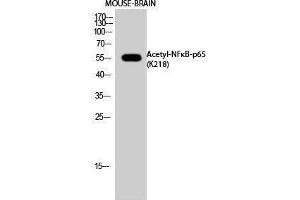 Western Blotting (WB) image for anti-Nuclear Factor-kB p65 (NFkBP65) (acLys218) antibody (ABIN3172840) (NF-kB p65 Antikörper  (acLys218))