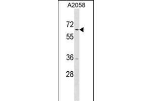 TRIM35 Antibody (C-term) (ABIN1537330 and ABIN2850370) western blot analysis in  cell line lysates (35 μg/lane). (TRIM35 Antikörper  (C-Term))