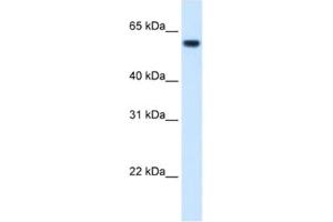Western Blotting (WB) image for anti-Formiminotransferase Cyclodeaminase (FTCD) antibody (ABIN2462433) (FTCD Antikörper)