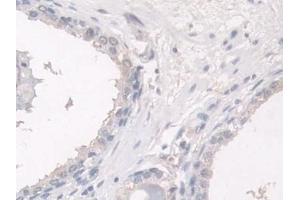 Immunohistochemistry (IHC) image for anti-Hermansky-Pudlak Syndrome 4 (HPS4) (AA 6-192) antibody (ABIN7443911)