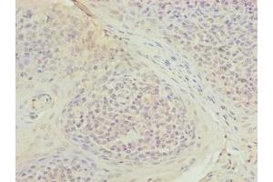 Immunohistochemistry of paraffin-embedded human tonsil tissue using ABIN7173675 at dilution of 1:100 (TUBB1 Antikörper  (AA 270-451))