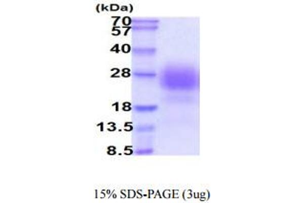 Syndecan 2 Protein (SDC2) (AA 19-144) (His tag)