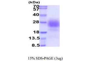 SDS-PAGE (SDS) image for Syndecan 2 (SDC2) (AA 19-144) protein (His tag) (ABIN6388065)
