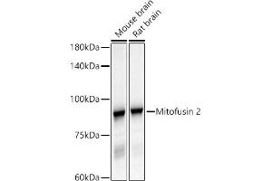 Western blot analysis of extracts of various cell lines, using Mitofusin 2 antibody (ABIN6133825, ABIN6143800, ABIN6143803 and ABIN6216518) at 1:500 dilution. (MFN2 Antikörper  (AA 500-600))