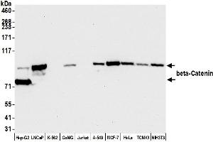 Western Blotting (WB) image for anti-Catenin, beta (CATNB) (AA 725-775) antibody (ABIN7455205) (Rekombinanter beta Catenin Antikörper  (AA 725-775))