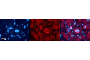Rabbit Anti-NFATC1 Antibody    Formalin Fixed Paraffin Embedded Tissue: Human Adult heart  Observed Staining: Cytoplasmic,Nuclear (nuclear membrane) Primary Antibody Concentration: 1:600 Secondary Antibody: Donkey anti-Rabbit-Cy2/3 Secondary Antibody Concentration: 1:200 Magnification: 20X Exposure Time: 0.