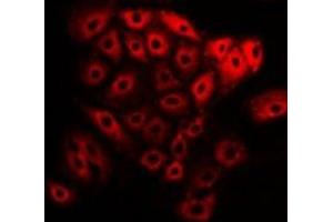 Immunofluorescent analysis of NEK2 staining in U2OS cells. (NEK2 Antikörper)