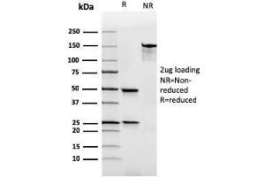 SDS-PAGE Analysis Purified IgA Recombinant Mouse Monoclonal Antibody (rHISA43). (Rekombinanter IGHA1 & IGHA2 Antikörper)