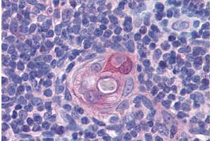 Immunohistochemistry (Formalin-fixed Paraffin-embedded Sections) (IHC (fp)) image for anti-PYD and CARD Domain Containing (PYCARD) (AA 31-46) antibody (ABIN604911)