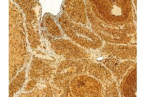 ABIN6262905, ABIN6268707, ABIN6268708 and ABIN6268709 at 1/100 staining Rat ovary tissue by IHC-P. (Lamin B1 Antikörper)
