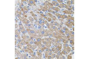 Immunohistochemistry of paraffin-embedded human liver injury using PIK3CG antibody (ABIN2564539) (40x lens).