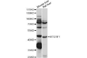 Western blot analysis of extracts of various cell lines, using MTERF1 antibody (ABIN6291170) at 1:1000 dilution. (MTERF Antikörper)