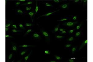 Immunofluorescence of monoclonal antibody to LMO4 on HeLa cell.