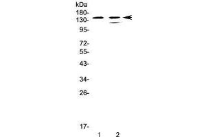 Western blot testing of human 1) CCRF-CEM and 2) SW620 cell lysate with SHIP1 antibody at 0.