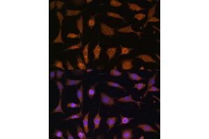 Immunofluorescence analysis of L929 cells using PDE6D Polyclonal Antibody (ABIN7269303) at dilution of 1:100 (40x lens). (PDE6D Antikörper  (AA 1-150))