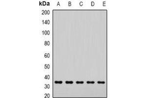 Western blot analysis of SNAP-alpha expression in Hela (A), Jurkat (B), mouse brain (C), mouse lung (D), rat liver (E) whole cell lysates. (NAPA Antikörper)