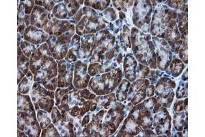 Immunohistochemical staining of paraffin-embedded colon tissue using anti-TPMT mouse monoclonal antibody. (TPMT Antikörper)