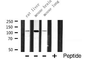 Western blot analysis of RBM26 expression in various lysates (RBM26 Antikörper  (Internal Region))