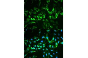 Immunofluorescence analysis of MCF7 cell using TIMP2 antibody. (TIMP2 Antikörper  (AA 100-200))