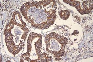 IHC analysis of TFAM using anti-TFAM antibody (ABIN7603113).