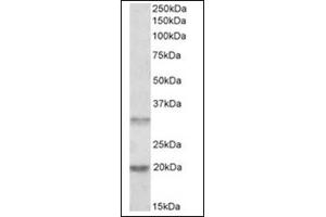Image no. 1 for anti-Asparaginase Like 1 (ASRGL1) (Internal Region) antibody (ABIN374933) (ASRGL1 Antikörper  (Internal Region))