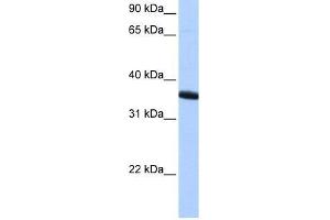 Western Blot showing ZNF389 antibody used at a concentration of 1-2 ug/ml to detect its target protein. (ZNF192P1 Antikörper  (N-Term))