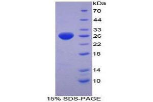 SDS-PAGE (SDS) image for Thioredoxin Reductase 1 (TXNRD1) (AA 374-577) protein (His tag) (ABIN2126945) (TXNRD1 Protein (AA 374-577) (His tag))