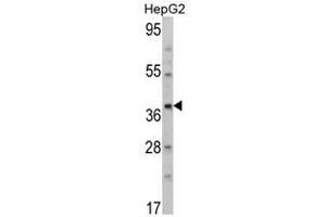 Image no. 1 for anti-Aminomethyltransferase (AMT) (N-Term) antibody (ABIN452734)