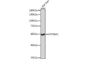 Western blot analysis of extracts of Rat liver, using CYP26 Rabbit mAb (ABIN7266654) at 1:1000 dilution. (CYP26A1 Antikörper)