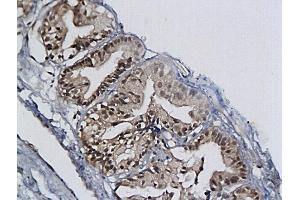 Immunohistochemistry (IHC) image for anti-Minichromosome Maintenance Complex Component 2 (MCM2) (AA 601-700) antibody (ABIN676238) (MCM2 Antikörper  (AA 601-700))