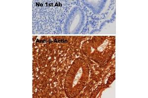Immunohistochemistry (IHC) image for anti-Actin, beta (ACTB) (N-Term) antibody (ABIN6254200)