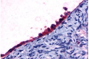 Anti-GPR108 antibody  ABIN1048687 IHC staining of human ovary, surface epithelium.