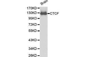 Western Blotting (WB) image for anti-CCCTC-Binding Factor (Zinc Finger Protein) (CTCF) (AA 1-260) antibody (ABIN6215164) (CTCF Antikörper  (AA 1-260))