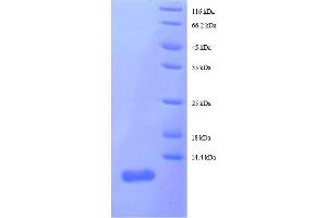 Ribosomal Protein L29 (RPL29) (AA 1-63), (full length) protein (His tag)