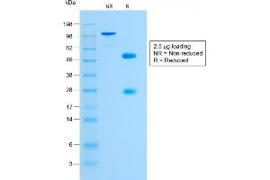 SDS-PAGE Analysis Purified Glycophorin A Rabbit Monoclonal Antibody (GYPA/1725R). (Rekombinanter CD235a/GYPA Antikörper)